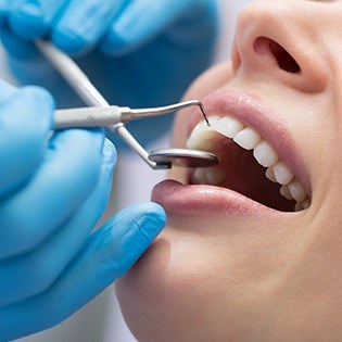 Healthy teeth and gums