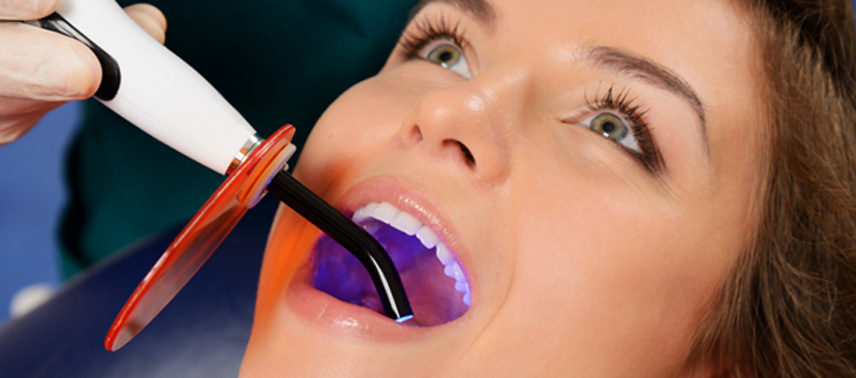 Dental bonding uses composite resin to repair damaged teeth