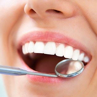 Closeup of healthy smile