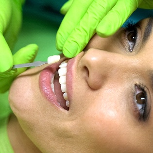 A woman having porcelain veneers placed