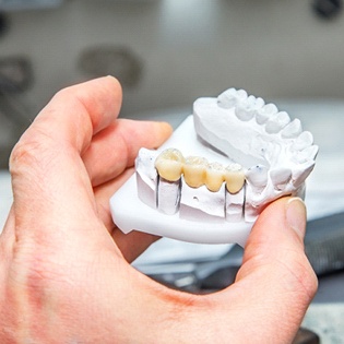 A dental lab technician creating a dental bridge based on the specifications provided by the dentist