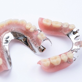 An up-close view of partial dentures created for a patient