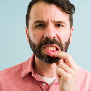 A man with gum disease