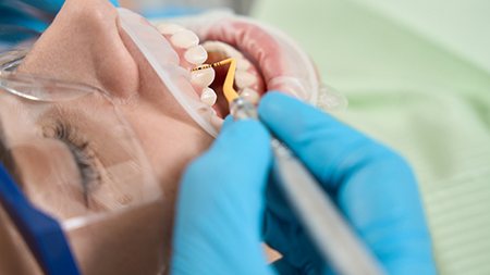 Patient having their gums charted