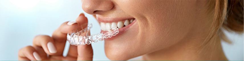 Woman wearing Invisalign