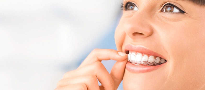 Woman wearing Invisalign