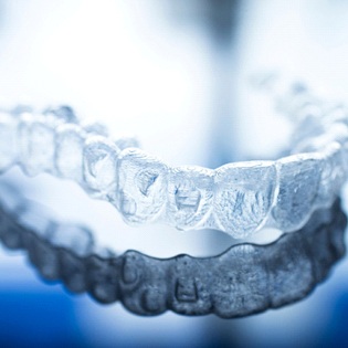 Invisalign aligner