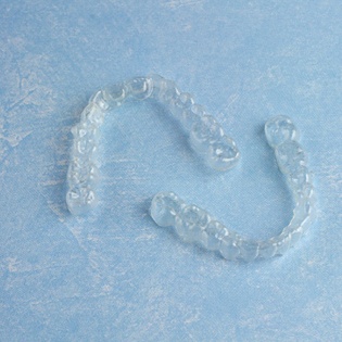 Invisalign aligners
