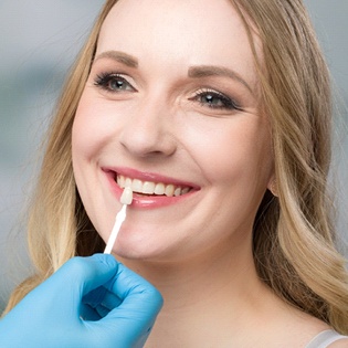 A dentist using a shade guide to determine the color of the veneer