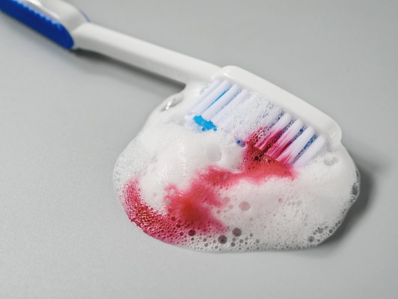 a manual toothbrush laying on its side with toothpaste foam and blood pooling around it