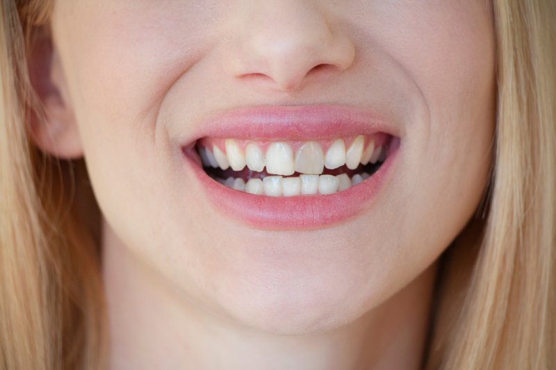 woman with a gray tooth